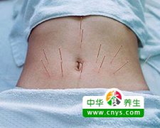 鼻炎犯了咋整 针灸治疗鼻炎有奇