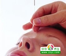 针灸如何减肥 这些常识你必须知