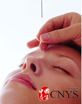 中医教你针灸七大穴位 可去皱美白抗衰老